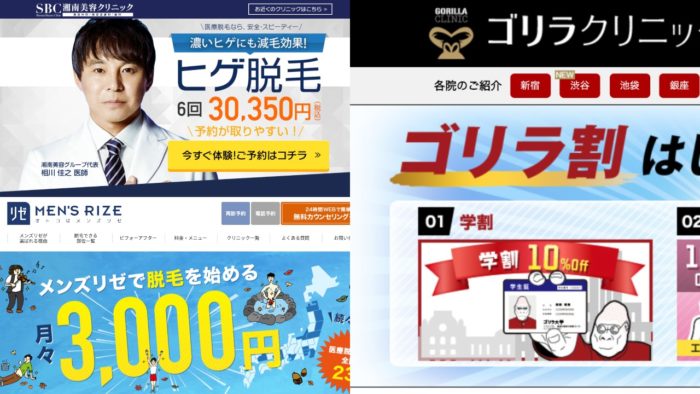 メンズ全身脱毛のメリットデメリット｜VIOが安いおすすめメンズ脱毛店3選
